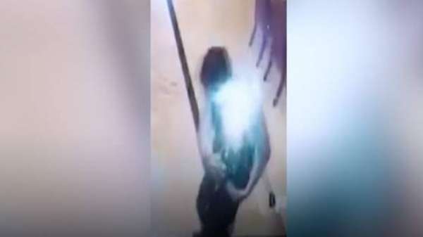 Mobile Phone Explodes In Man's Pocket And Sets His Shirt On Fire
