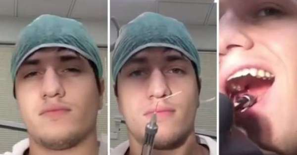 Dentist Pulls Out Own Wisdom Tooth On Mirror